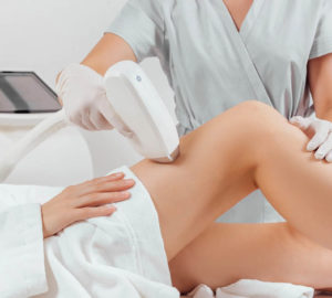 ventajas de la fotodepilación