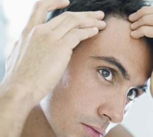 tratamientos alopecia